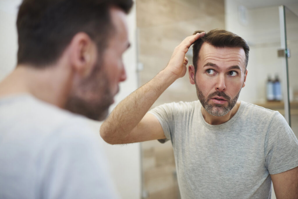 haircuts for balding men header image.jpg